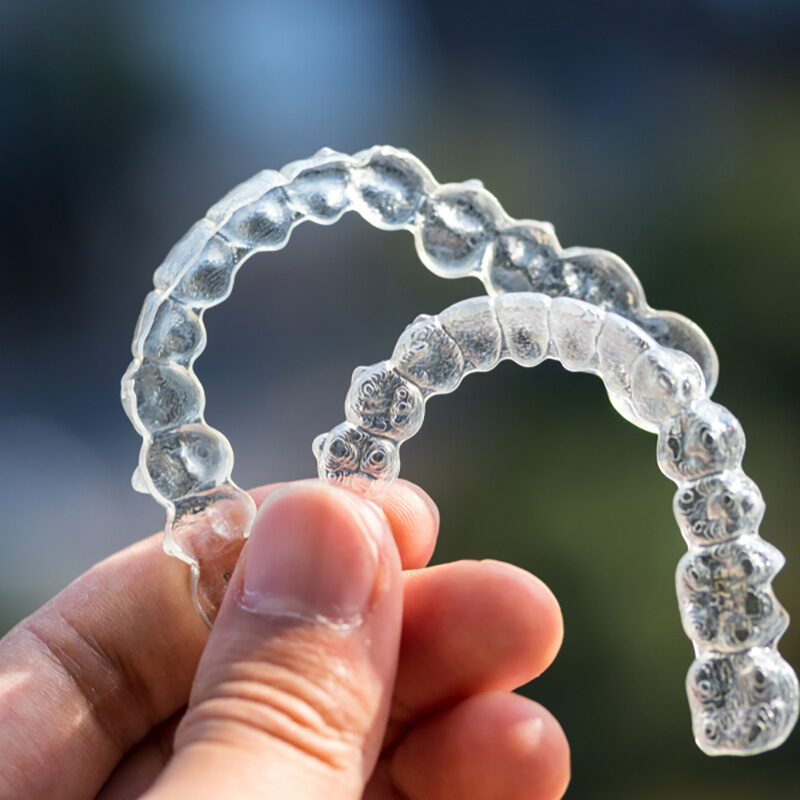 why choose invisalign, dentist vancouver, vancouver dentist, invisalign kitsilano