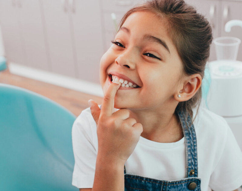 chipped tooth, chipped tooth vancouver, chipped tooth kitsilano